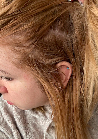 Before hair appearance 1