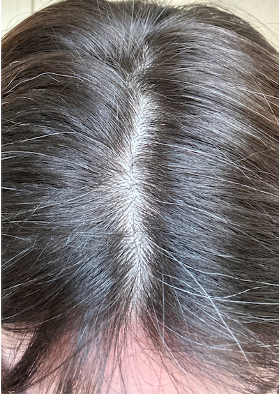 Before hair appearance 3